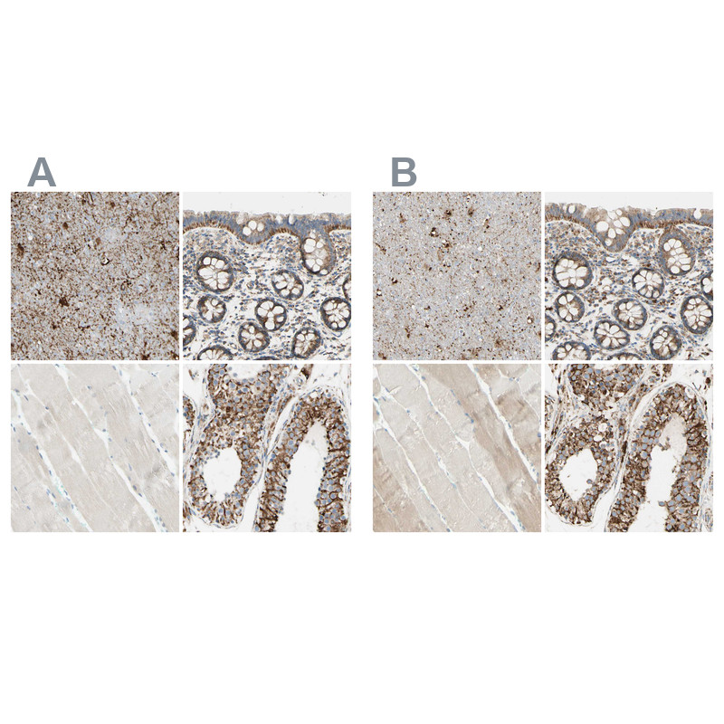 Immunohistochemical staining of human cerebral cortex, colon, skeletal muscle and testis using Anti-ARMC10 antibody HPA011057 (A) shows similar protein distribution across tissues to independent antibody HPA011036 (B).