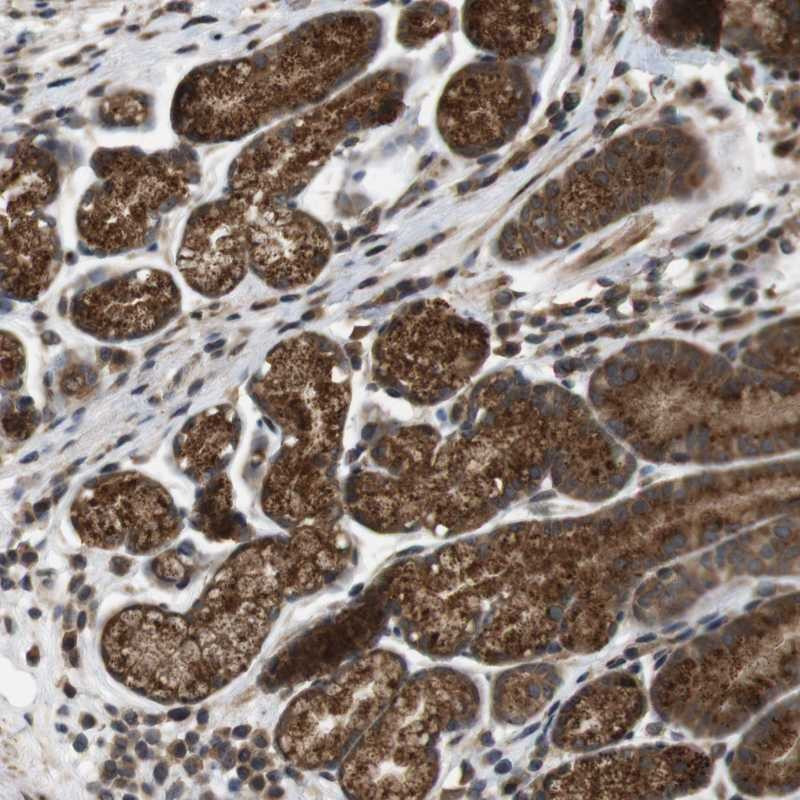 Immunohistochemical staining of human stomach shows strong cytoplasmic positivity in glandular cells.