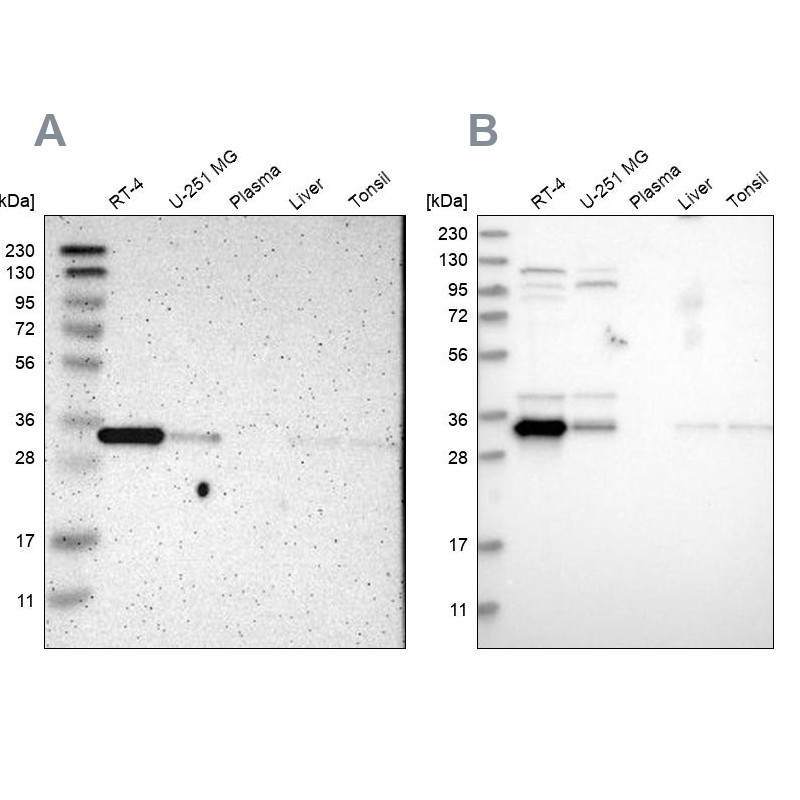 Western blot analysis using Anti-CASP6 antibody HPA011337 (A) shows similar pattern to independent antibody HPA024303 (B).