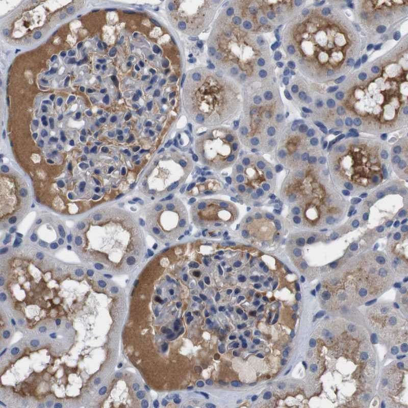 Immunohistochemical staining of human kidney shows positivity in plasma.