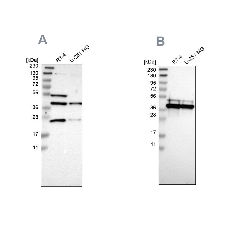 Western blot analysis using Anti-CCDC51 antibody HPA011408 (A) shows similar pattern to independent antibody HPA010980 (B).