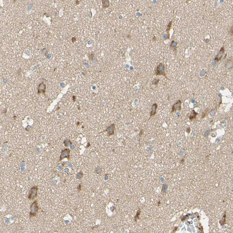 Immunohistochemical staining of human cerebral cortex shows moderate to strong cytoplasmic positivity in neurons.