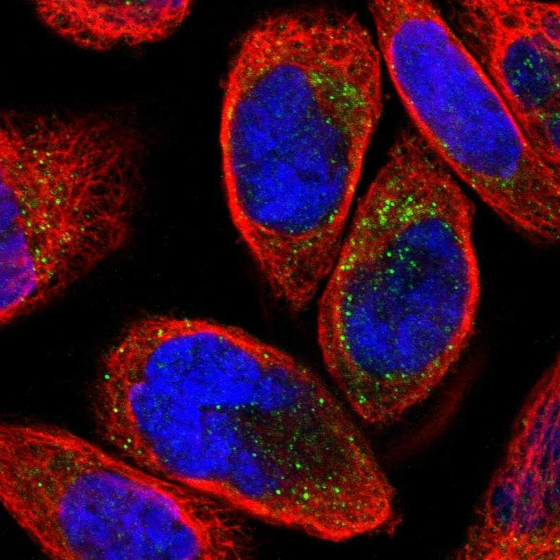 Immunofluorescent staining of human cell line A-431 shows localization to vesicles.