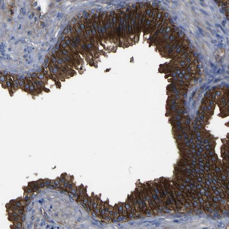 Immunohistochemical staining of human prostate shows strong cytoplasmic and membranous positivity in glandular cells.