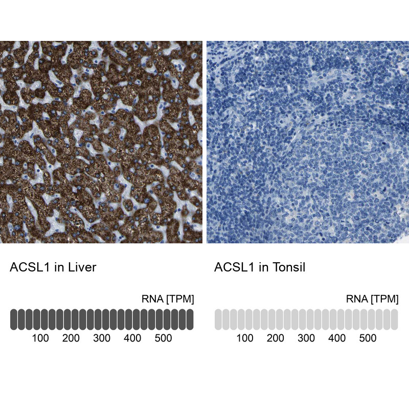 Immunohistochemistry analysis in human liver and tonsil tissues using HPA011964 antibody. Corresponding ACSL1 RNA-seq data are presented for the same tissues.