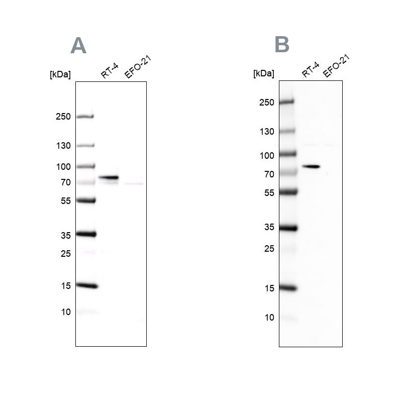 Western blot analysis using Anti-ACSL1 antibody HPA011964 (A) shows similar pattern to independent antibody HPA011316 (B).