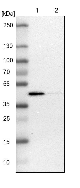 Lane 1: NIH-3T3 cell lysate (Mouse embryonic fibroblast cells)<br/>Lane 2: NBT-II cell lysate (Rat Wistar bladder tumour cells)