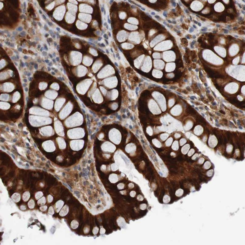 Immunohistochemical staining of human colon shows strong cytoplasmic positivity in glandular cells.
