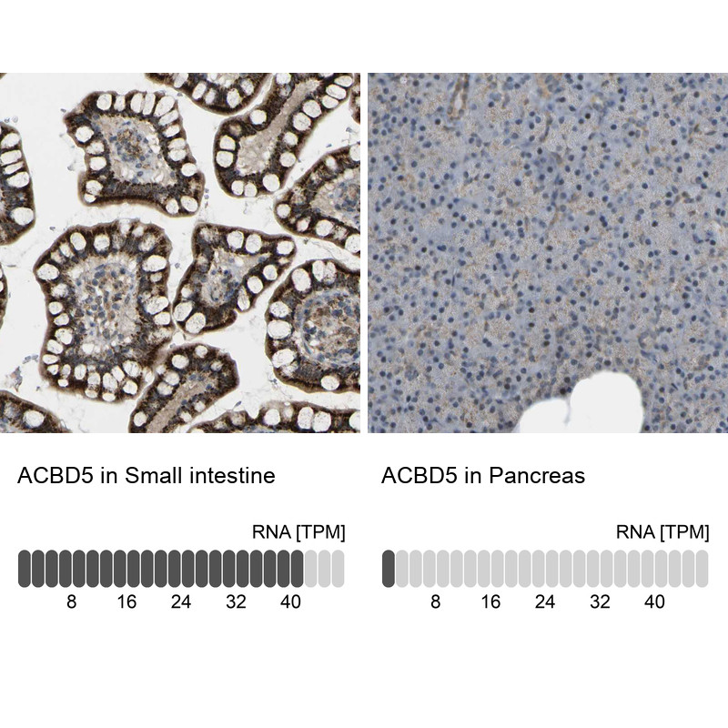 Immunohistochemistry analysis in human small intestine and pancreas tissues using HPA012145 antibody. Corresponding ACBD5 RNA-seq data are presented for the same tissues.