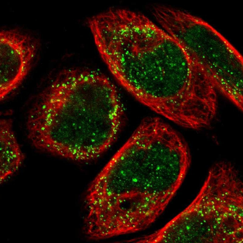 Immunofluorescent staining of human cell line A-431 shows localization to nucleus & peroxisomes.