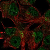 Immunofluorescent staining of human cell line SK-MEL-30 shows localization to nucleoplasm & the Golgi apparatus.