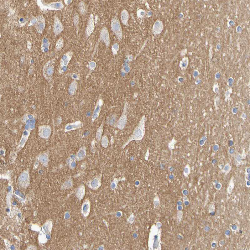 Immunohistochemical staining of human cerebral cortex shows moderate cytoplasmic positivity in neuropil.