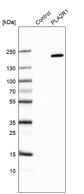 Western blot analysis in control (vector only transfected HEK293T lysate) and PLA2R1 over-expression lysate (Co-expressed with a C-terminal myc-DDK tag (~3.1 kDa) in mammalian HEK293T cells, LY423477).