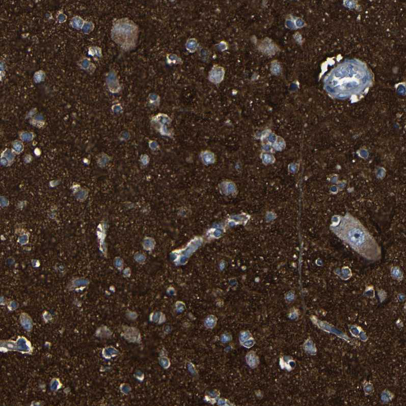 Immunohistochemical staining of human cerebral cortex shows  strong positivity in neuropil.