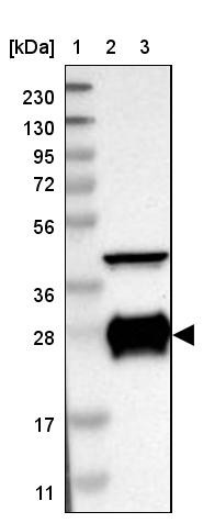 Lane 1: Marker [kDa] 230, 130, 95, 72, 56, 36, 28, 17, 11<br/>Lane 2: Human cell line RT-4<br/>Lane 3: Human cell line U-251MG sp