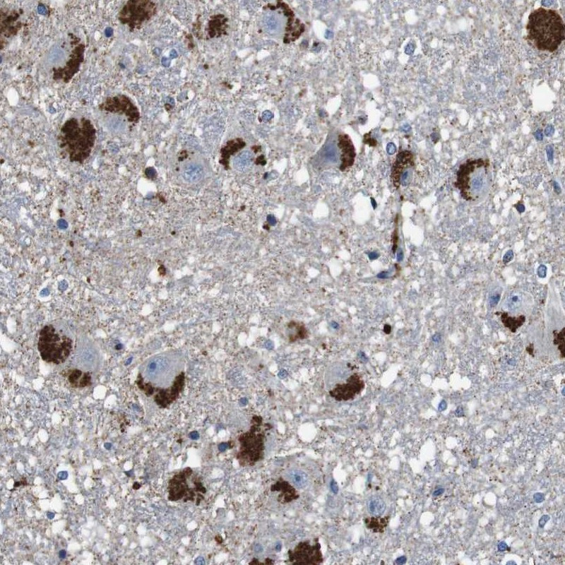 Immunohistochemical staining of human hippocampus shows strong cytoplasmic positivity, with a granular pattern, in neuronal and glial cells.