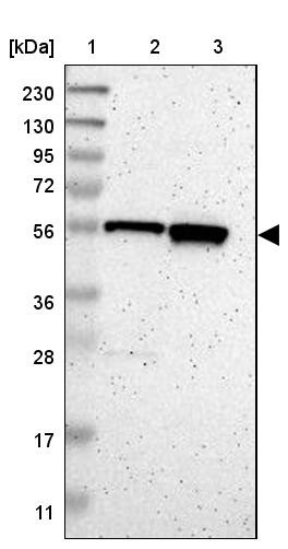 Lane 1: Marker [kDa] 230, 130, 95, 72, 56, 36, 28, 17, 11<br/>Lane 2: Human cell line RT-4<br/>Lane 3: Human cell line U-251MG sp