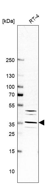Western blot analysis in human cell line RT-4.