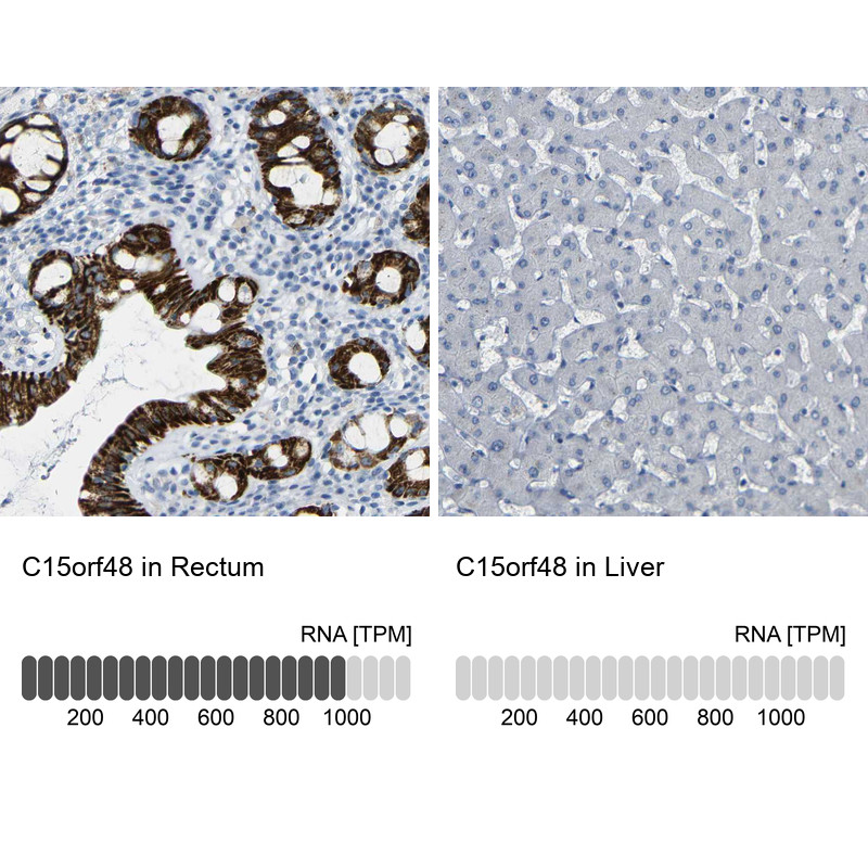 Immunohistochemistry analysis in human rectum and liver tissues using HPA012943 antibody. Corresponding C15orf48 RNA-seq data are presented for the same tissues.
