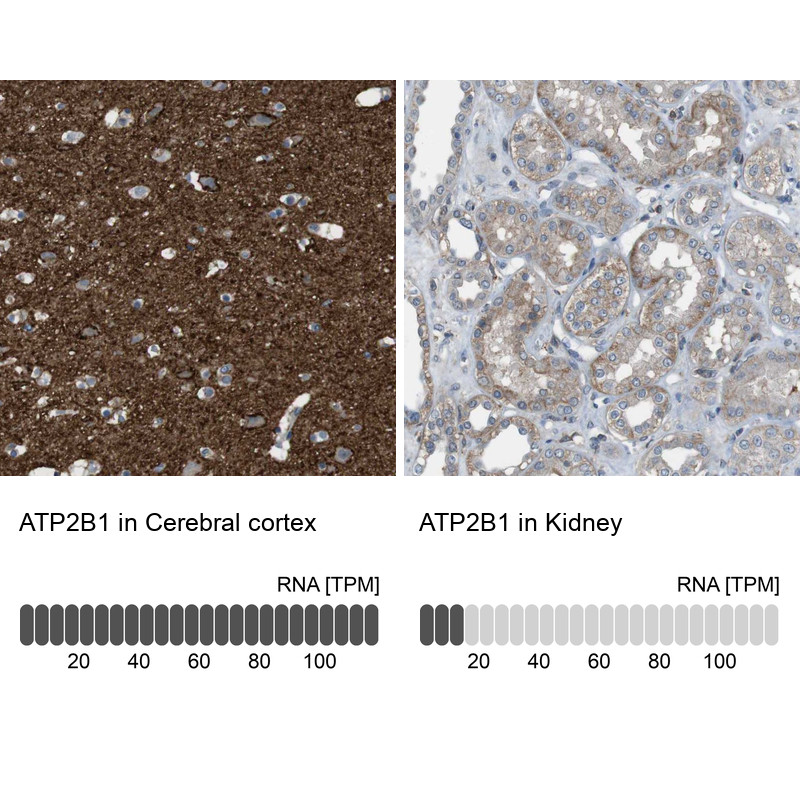 Immunohistochemistry analysis in human cerebral cortex and kidney tissues using Anti-ATP2B1 antibody. Corresponding ATP2B1 RNA-seq data are presented for the same tissues.