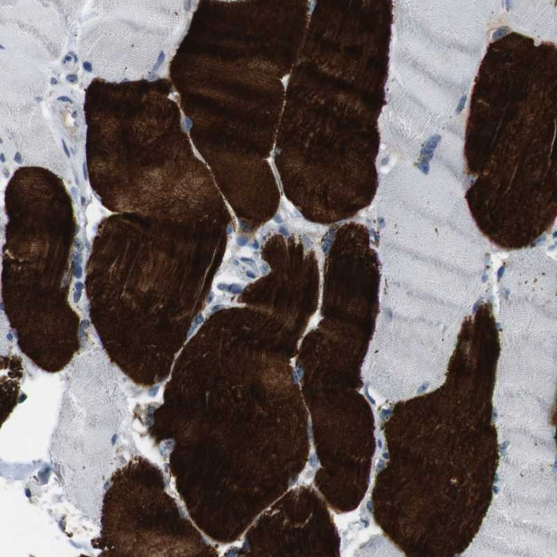 Immunohistochemical staining of human skeletal muscle shows strong cytoplasmic positivity in myocytes.