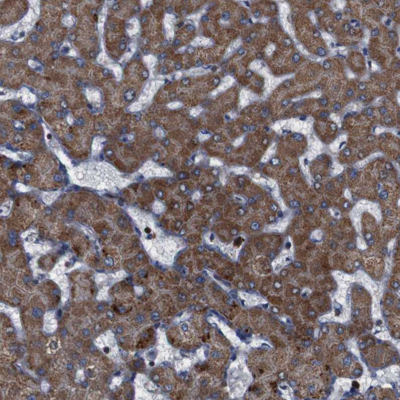 Immunohistochemical staining of human Liver shows strong granular cytoplasmic positivity in hepatocytes.