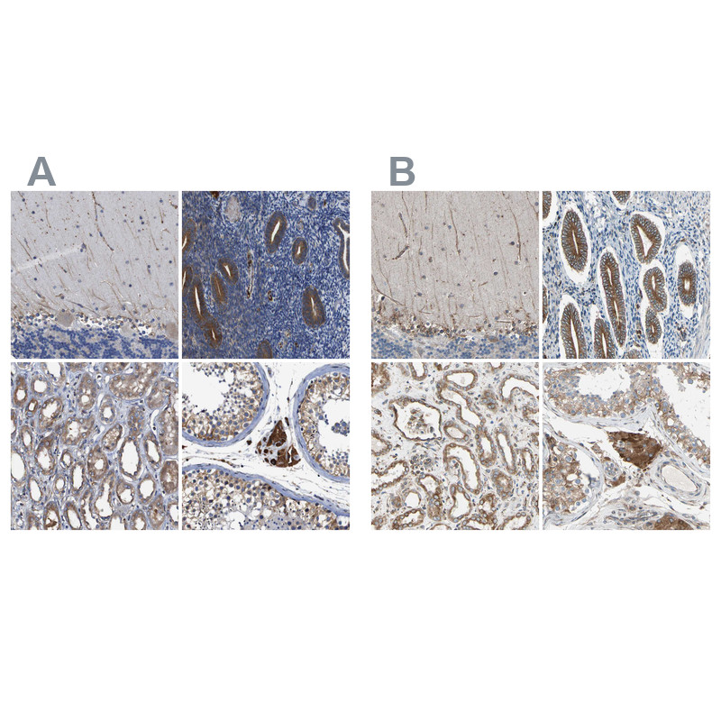 Immunohistochemical staining of human cerebellum, endometrium, kidney and testis using Anti-CLCC1 antibody HPA013210 (A) shows similar protein distribution across tissues to independent antibody HPA009087 (B).