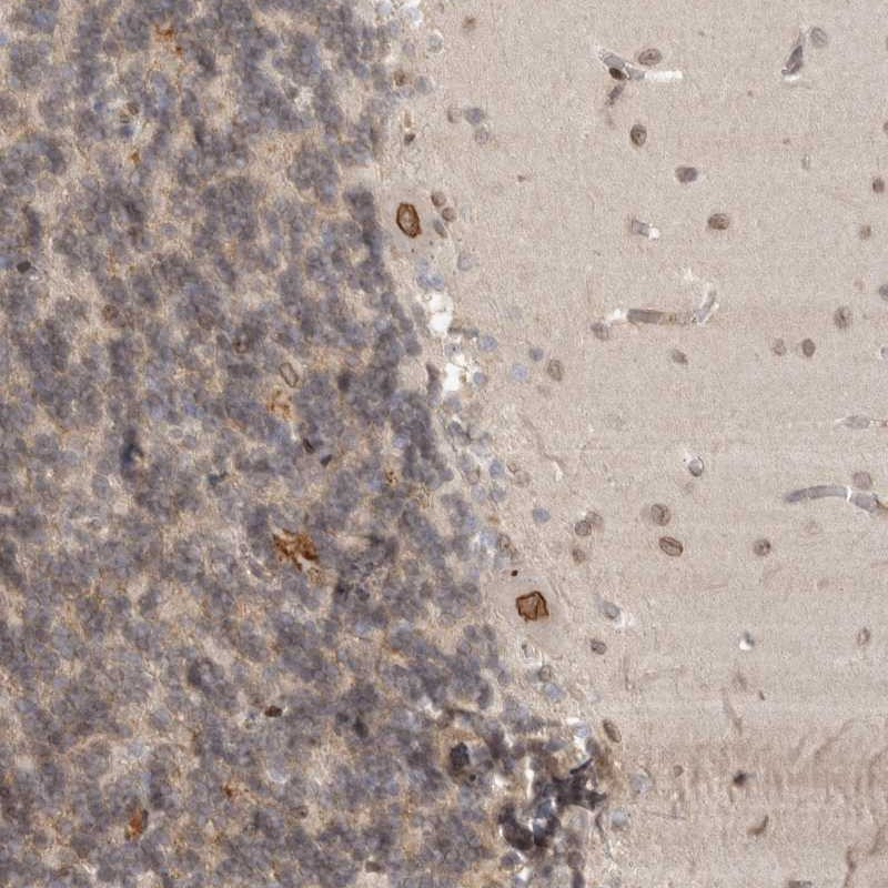 Immunohistochemical staining of human cerebellum shows strong nuclear membranous positivity in Purkinje cells.