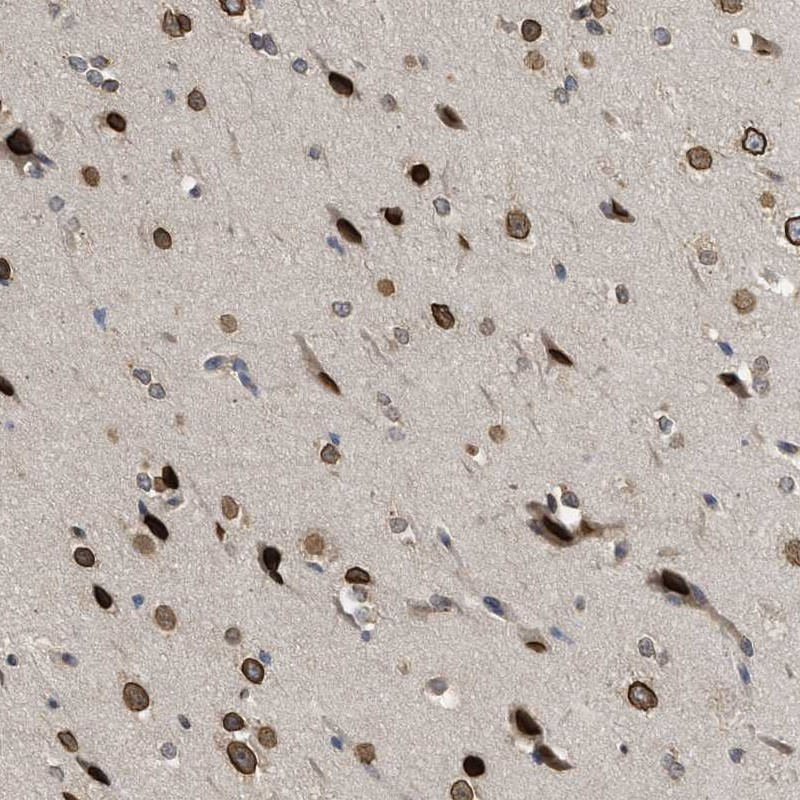 Immunohistochemical staining of human cerebral cortex shows strong nuclear positivity in neuronal cells and glial cells.