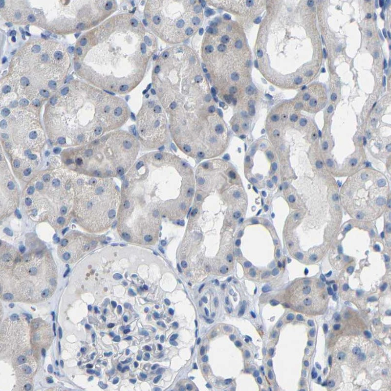 Immunohistochemical staining of human kidney shows nucleolar positivity in renal tubules.