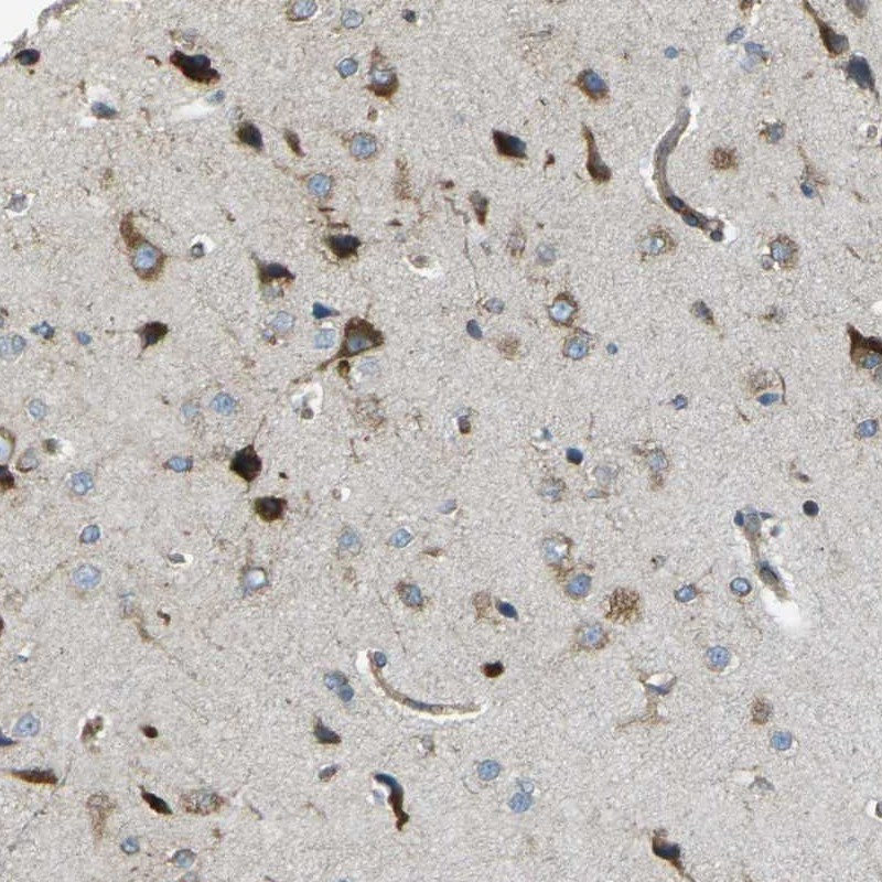 Immunohistochemical staining of human cerebral cortex shows strong nuclear and cytoplasmic positivity in neuronal cells.