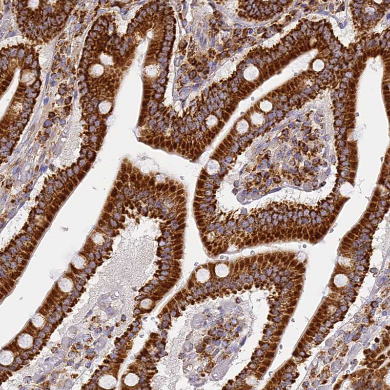 Immunohistochemical staining of human duodenum shows strong granular cytoplasmic positivity in glandular cells.