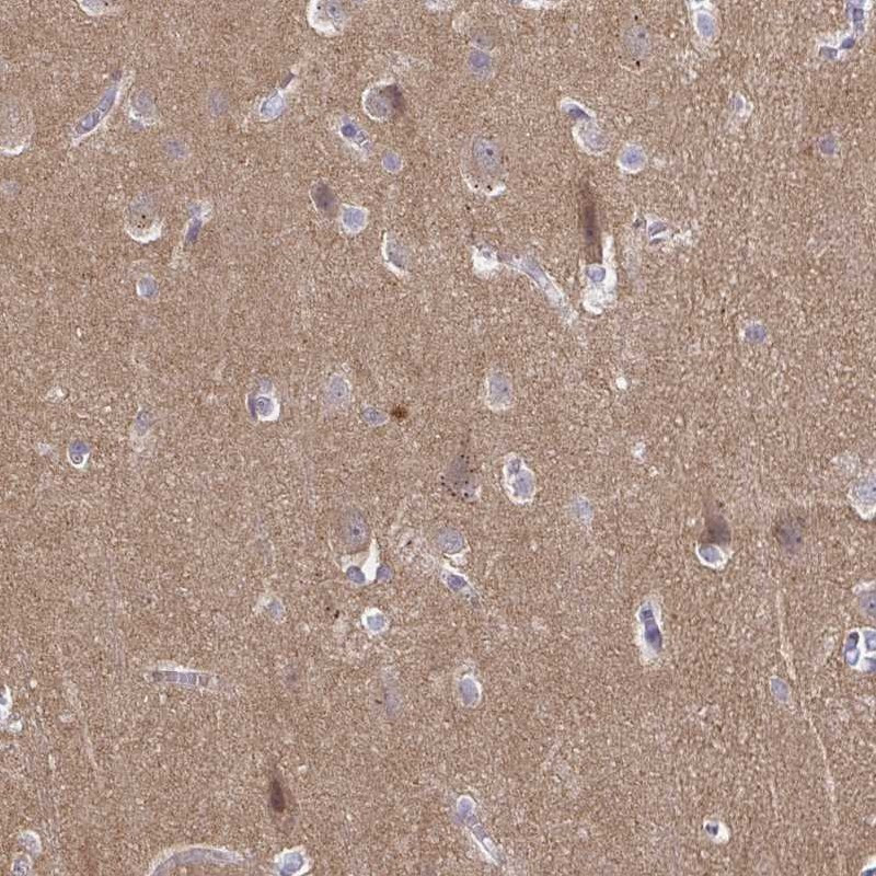 Immunohistochemical staining of human cerebral cortex shows moderate positivity in neuropil.