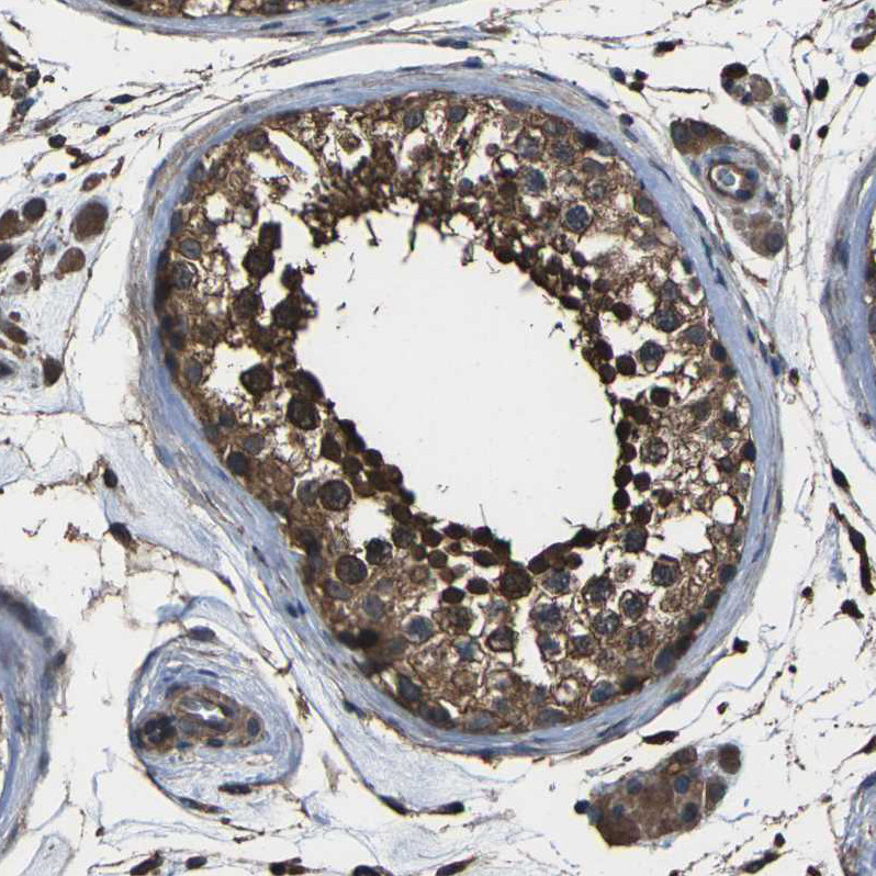 Immunohistochemical staining of human testis shows moderate to strong cytoplasmic positivity in cells in seminiferous ducts.