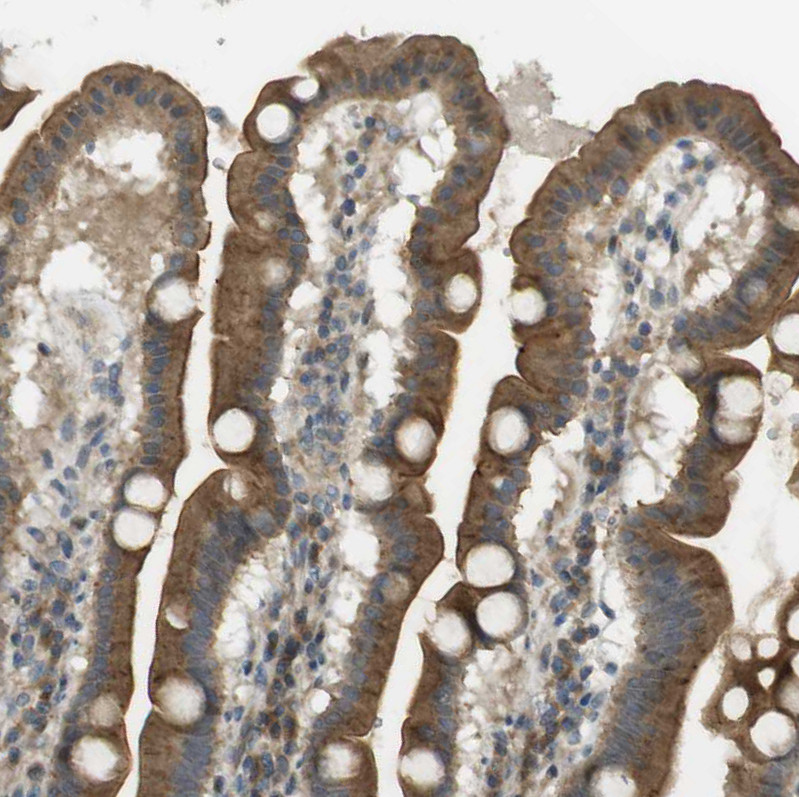 Immunohistochemical staining of human duodenum shows moderate cytoplasmic and membranous positivity in glandular cells.