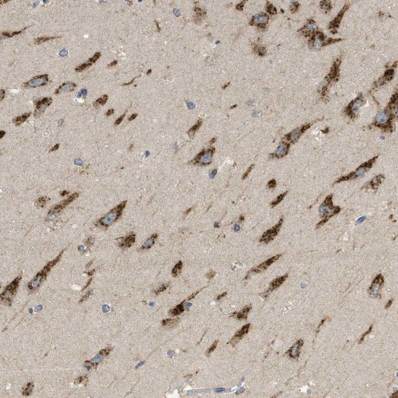 Immunohistochemical staining of human hippocampus shows cytoplasmic positivity with a granular pattern in neuronal cells.
