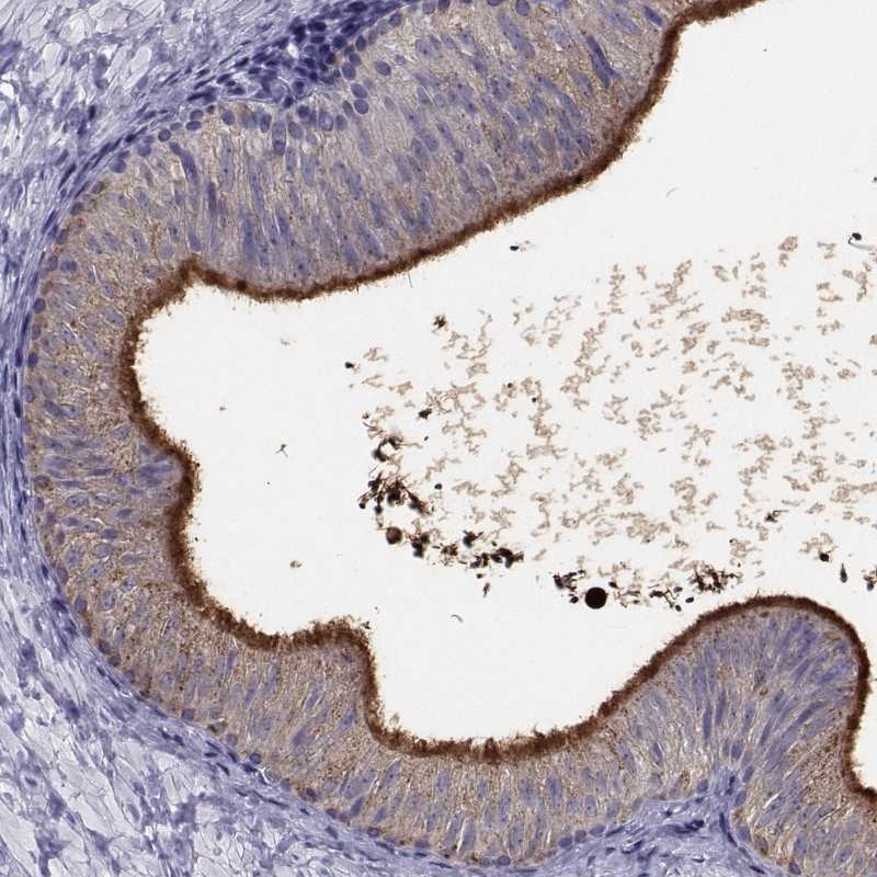 Immunohistochemical staining of human epididymis shows strong positivity in stereocilia of glandular cells.