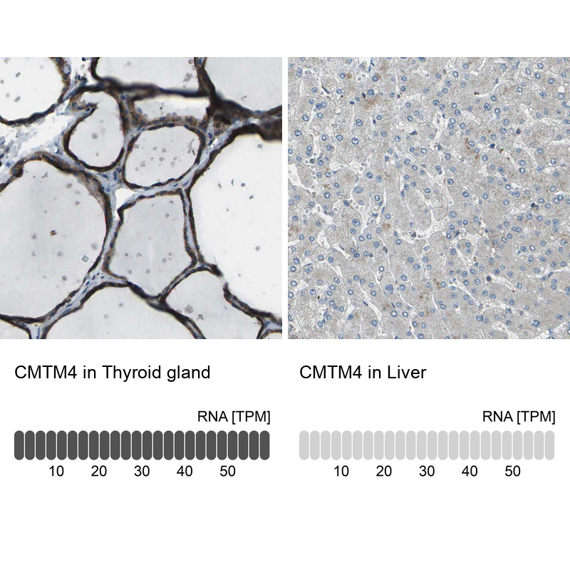 Immunohistochemistry analysis in human thyroid gland and liver tissues using HPA014704 antibody. Corresponding CMTM4 RNA-seq data are presented for the same tissues.
