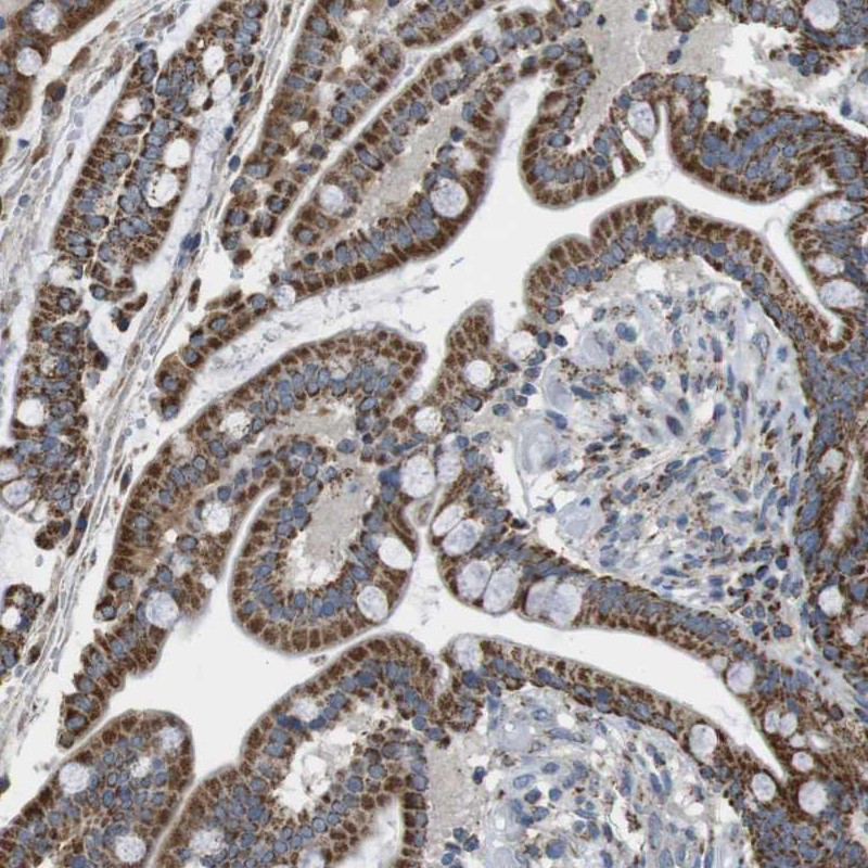 Immunohistochemical staining of human colon shows strong cytoplasmic positivity in glandular cells.