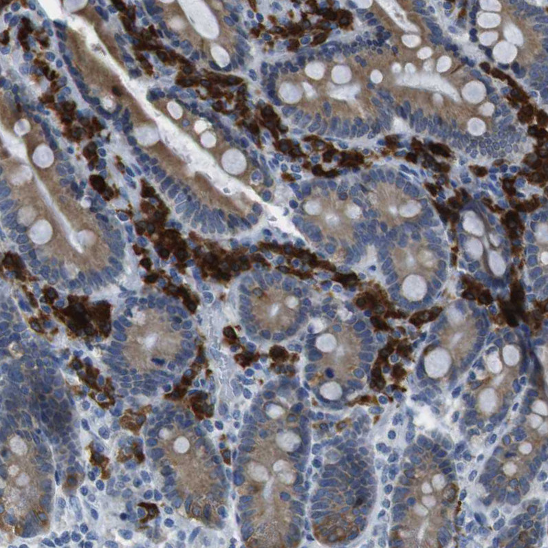 Immunohistochemical staining of human duodenum shows strong cytoplasmic positivity in lymphoid cells.