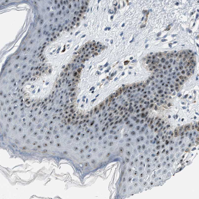 Immunohistochemical staining of human skin shows strong nuclear positivity in squamous epithelial cells.