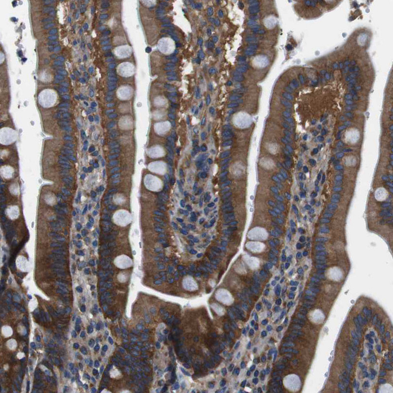 Immunohistochemical staining of human duodenum shows moderate to strong cytoplasmic positivity in glandular cells.