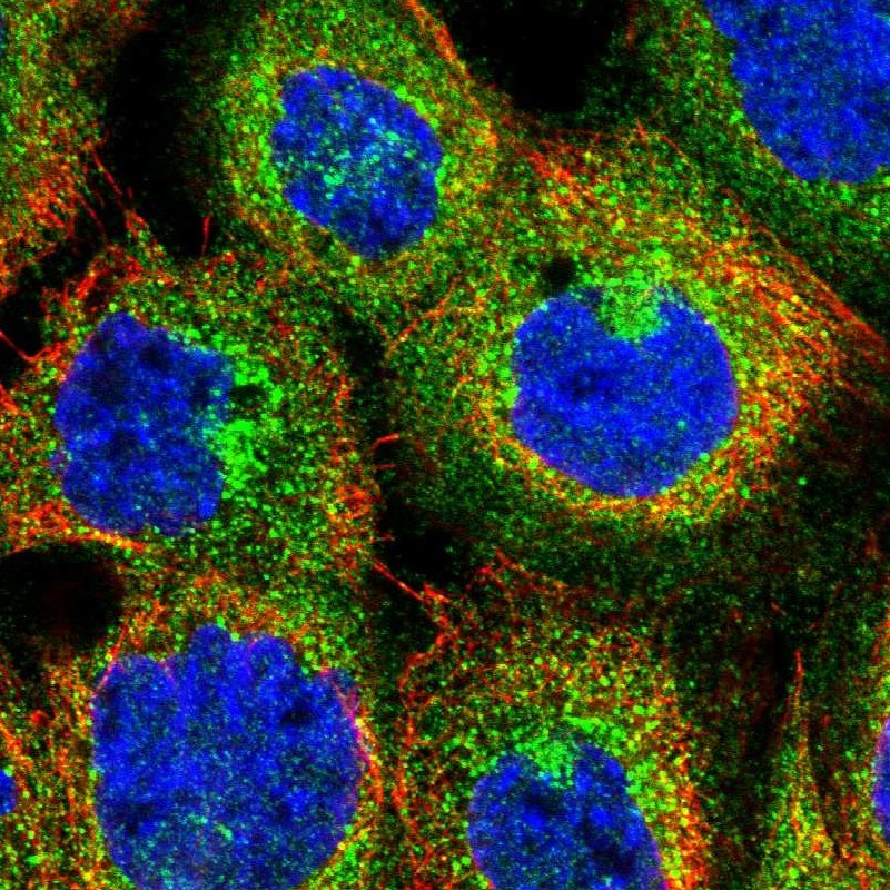 Immunofluorescent staining of human cell line A-431 shows localization to cytosol, the Golgi apparatus & vesicles.