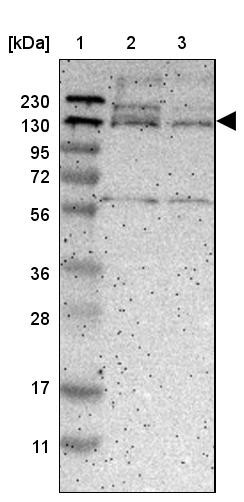 Lane 1: Marker [kDa] 230, 130, 95, 72, 56, 36, 28, 17, 11<br/>Lane 2: Human cell line RT-4<br/>Lane 3: Human cell line U-251MG sp