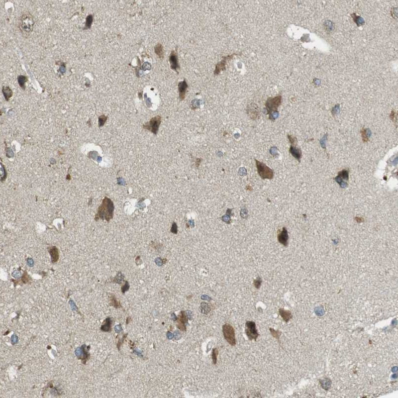 Immunohistochemical staining of human cerebral cortex shows strong cytoplasmic positivity in neuronal cells.