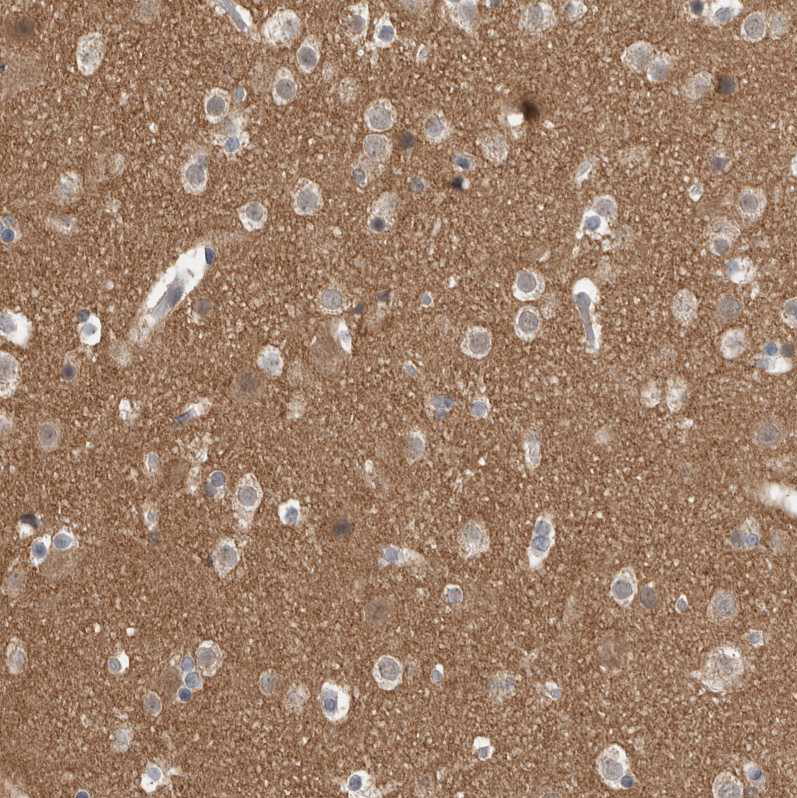 Immunohistochemical staining of human cerebral cortex shows moderate positivity in neuropil.