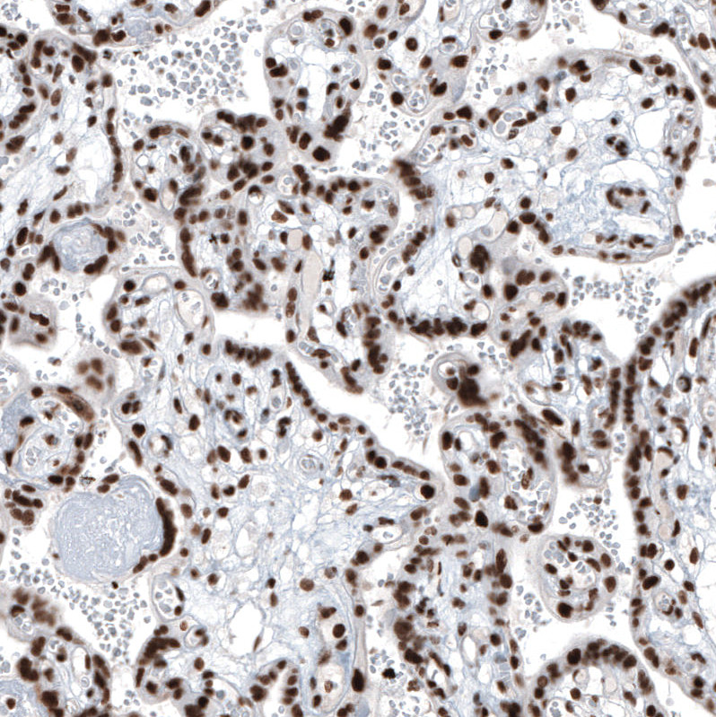 Immunohistochemical staining of human placenta shows moderate to strong nuclear positivity in trophoblastic cells.