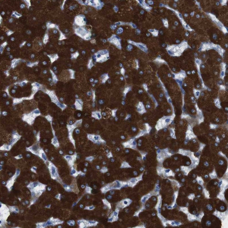 Immunohistochemical staining of human liver shows strong cytoplasmic positivity in hepatocytes.