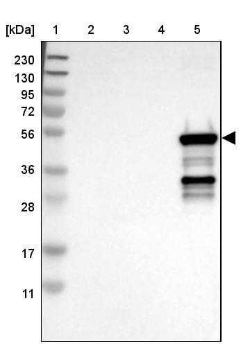 Lane 1: Marker [kDa] 230, 130, 95, 72, 56, 36, 28, 17, 11<br/>Lane 2: Human cell line RT-4<br/>Lane 3: Human cell line U-251MG sp<br/>Lane 4: Human plasma (IgG/HSA depleted)<br/>Lane 5: Human liver tissue