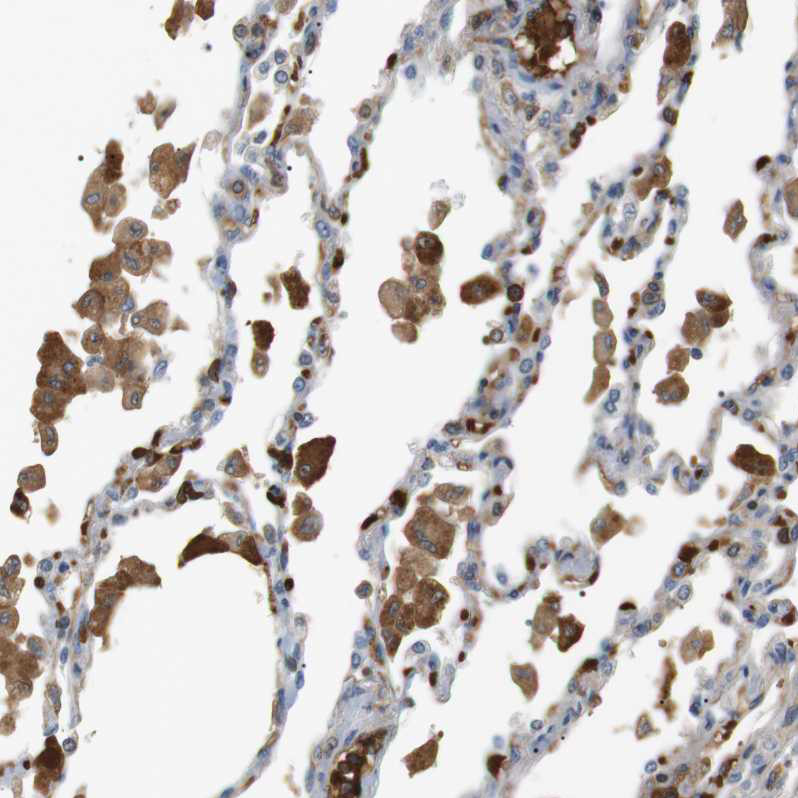 Immunohistochemical staining of human lung shows moderate cytoplasmic positivity in macrophages.